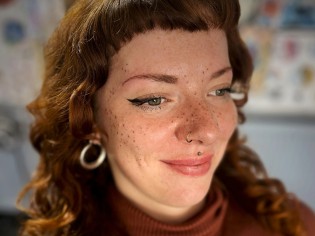 Frizz Kassel - eine Faux Freckles-Behandlung