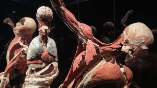 Hallo München - 3x2 Tickets für die „Körperwelten“-Ausstellung in der Kleinen Olympiahalle, München.